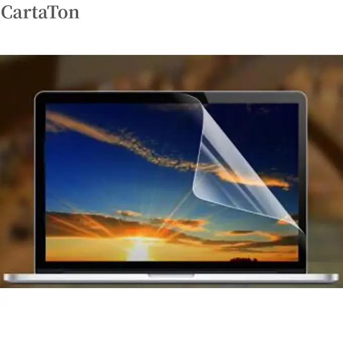 Film de protection anti-reflet mat pour écran Macbook Pro Retina 15 pouces A1398 sans éblouissement pour visibilité optimale et protection discrète